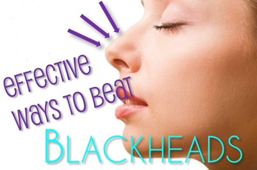 Blackhead-removal